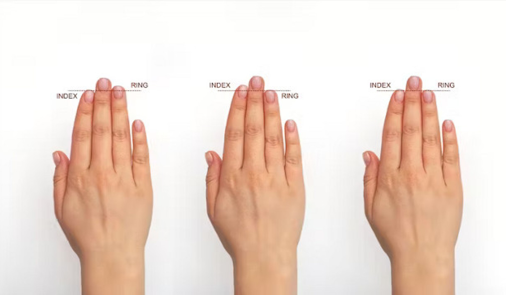 Unlocking Health Secrets Through Your Hands: From Nail Changes to Finger Length